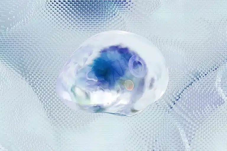 aneurisma cerebral