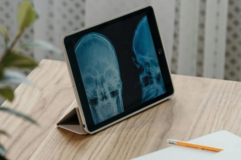 Tablet con análisis de los síntomas de un trastorno craneoencefálico