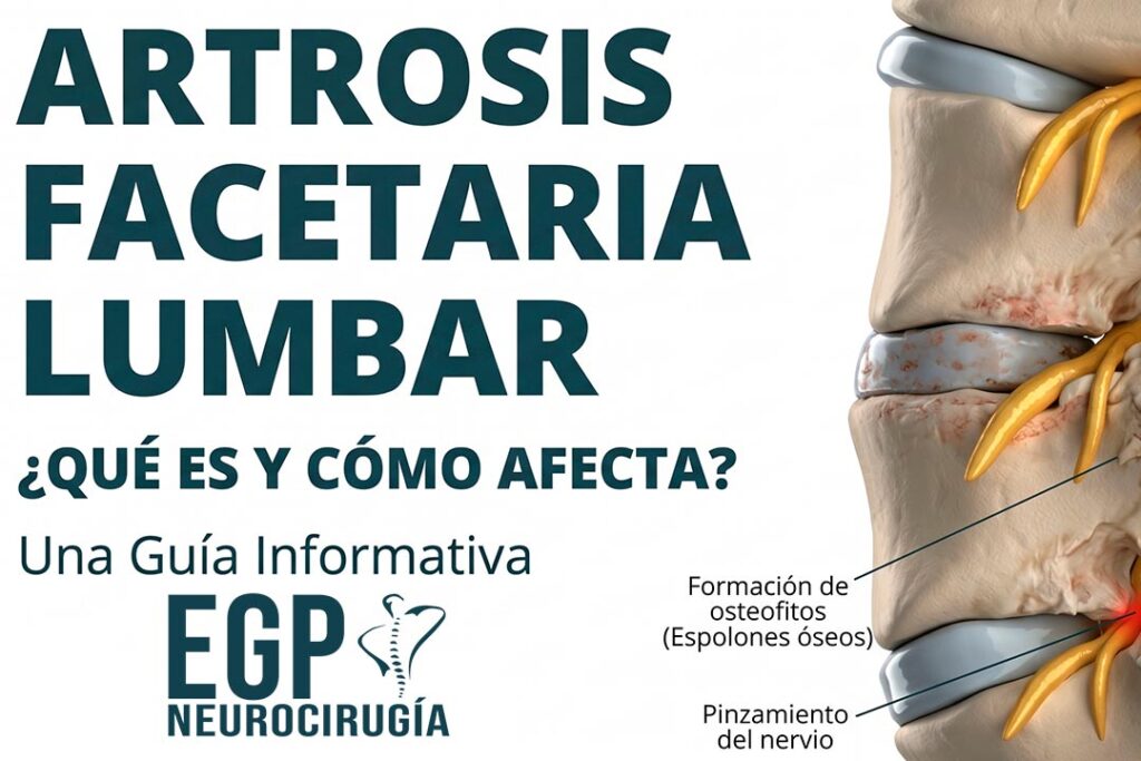 artrosis facetaria lumbar